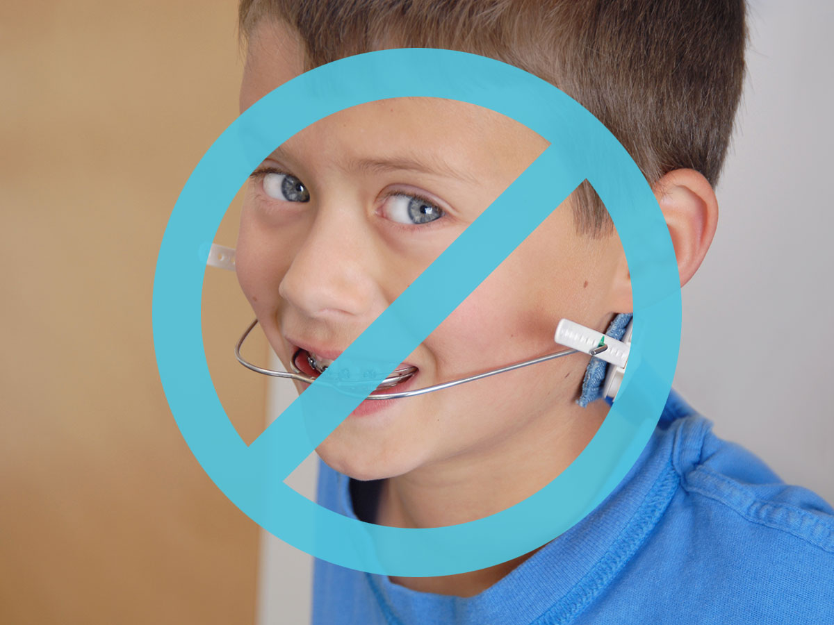 Alternativen zur Aussenzahnspange Dr. Manja Nido, Fachärztin für